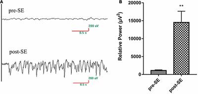 The Neuroprotective Effect of Astaxanthin on Pilocarpine-Induced Status Epilepticus in Rats